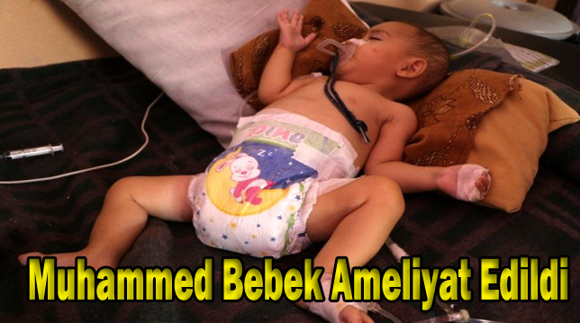 Muhammed bebek ameliyat edildi